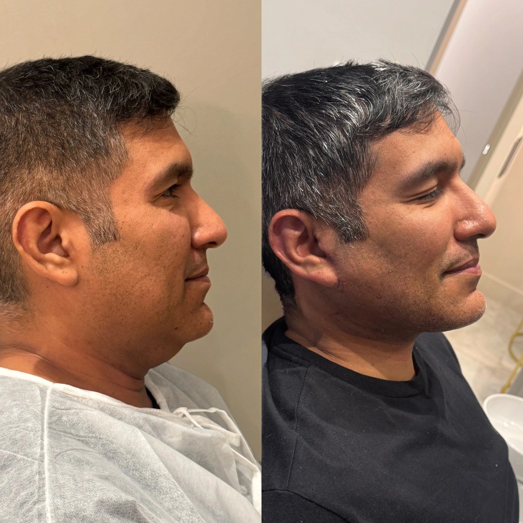 Galeria de resultados: antes e depois