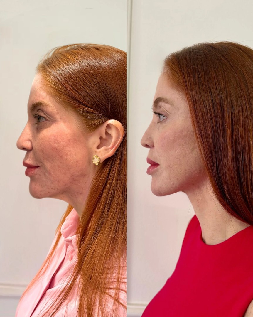 Galeria de resultados: antes e depois